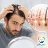 ریزش مو؛ آیا موهای نازک و ریخته دوباره رشد می‌کنند؟